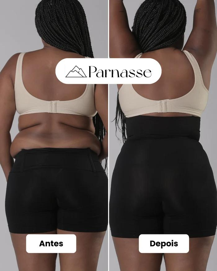 Body Modelador - UltraSlim™ [Compre 1 e Leve 2]